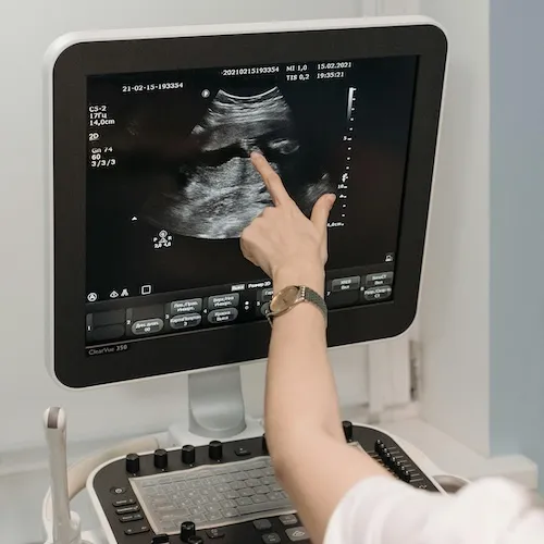 ecografie